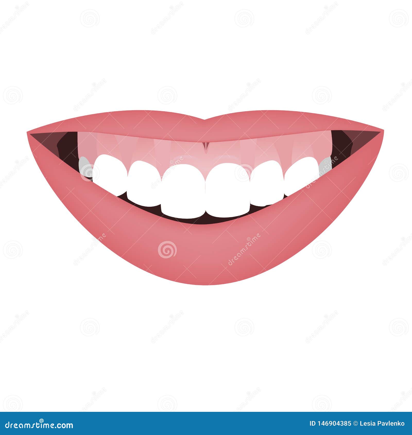 mouth with a distal bite and high smile line or gummy smile before the orthotropics or orthotropics treatment. 