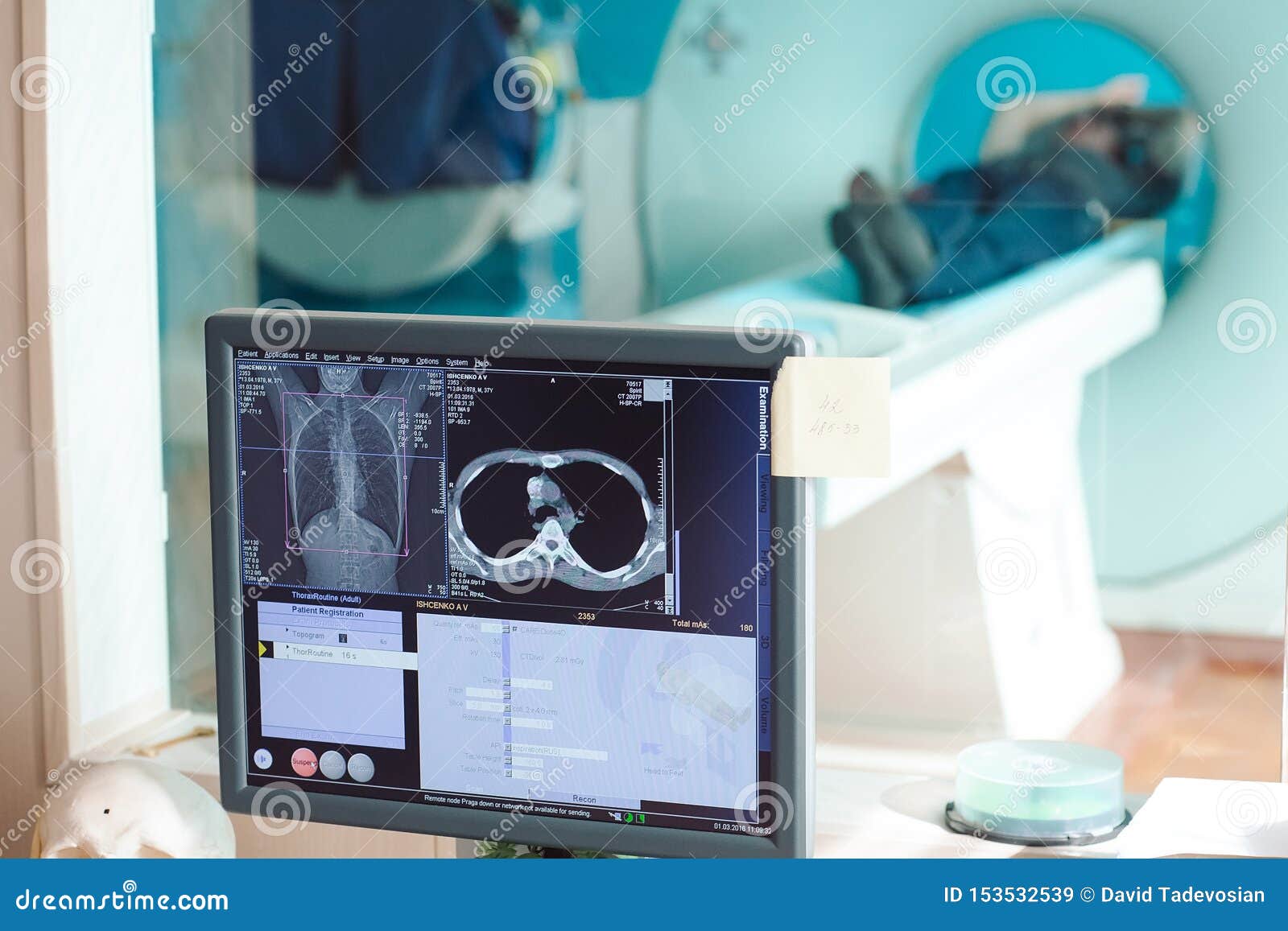 MRI Machine and Screens with Doctor and Nurse Stock Image Image of