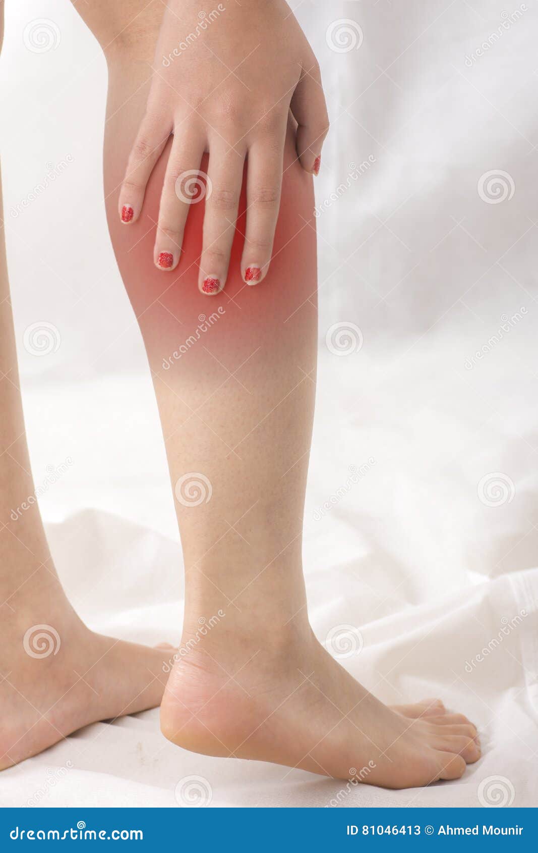 Menstruacion Y Dolor De Piernas Mujer Que Tiene Dolor En Su Pierna Imagen de archivo - Imagen de salud