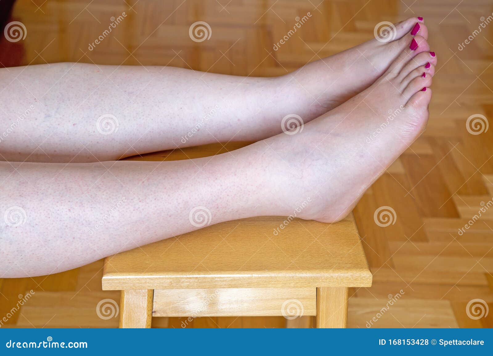 persecucion tiburón Misión Mujeres Embarazadas Con Los Pies Hinchados Foto de archivo - Imagen de hembra, mujer: 168153428 persecucion tiburón Misión Mujeres Embarazadas Con Los Pies Hinchados Foto de archivo - Imagen de hembra, mujer: 168153428