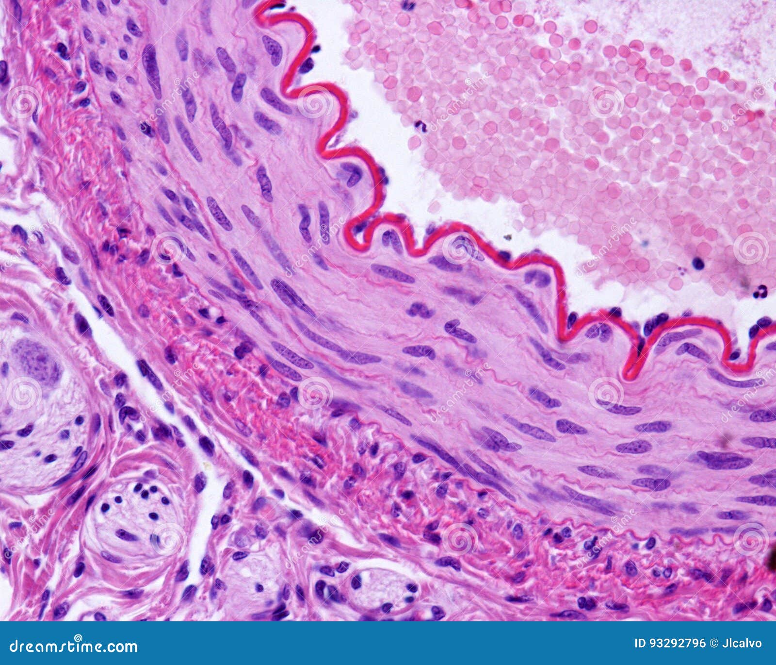 Muscular artery stock photo. Image of microscopy, lamina 93292796