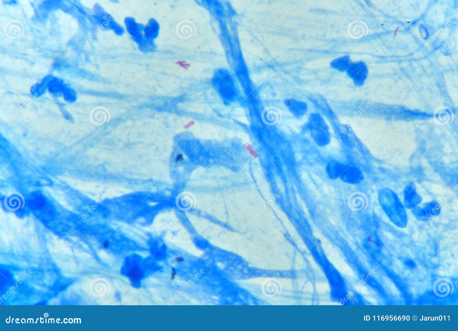 Кумы в мокроте. Mycobacterium tuberculosis в мокроте. Mycobacterium tuberculosis в мокроте больного,. Микобактерии изображение в микроскоп. Микроскопия мокроты на БК.