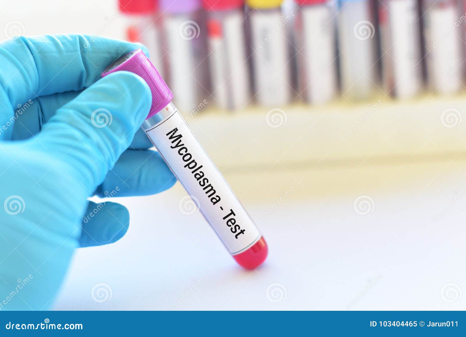 Mycoplasma bacteria test stock image. Image of analyzing 103404465