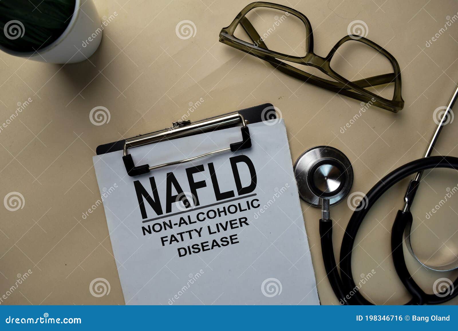 nafld - non-alcoholic fatty liver disease write on a paperwork  on office desk