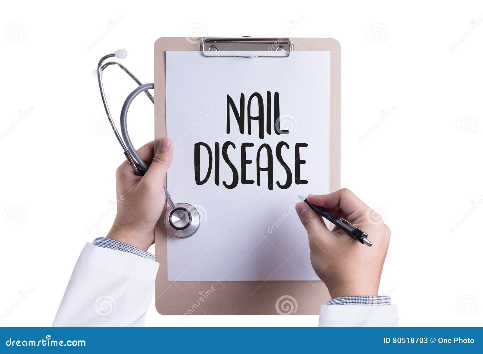 nail disease fungus infection on nails hand, finger with onycho