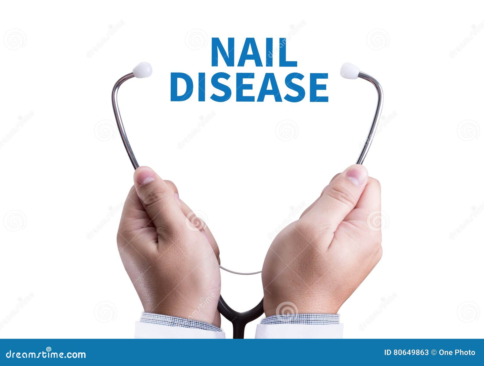 nail disease fungus infection on nails hand, finger with onycho