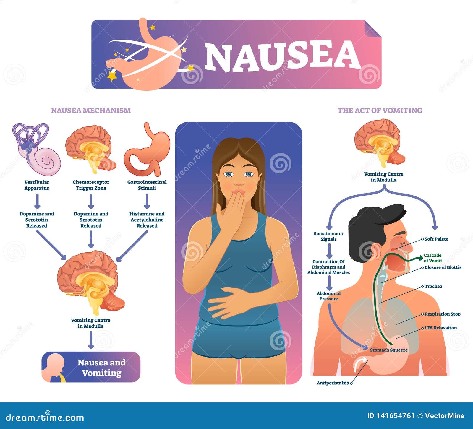 nausea  . labeled medical vomiting explanation scheme.