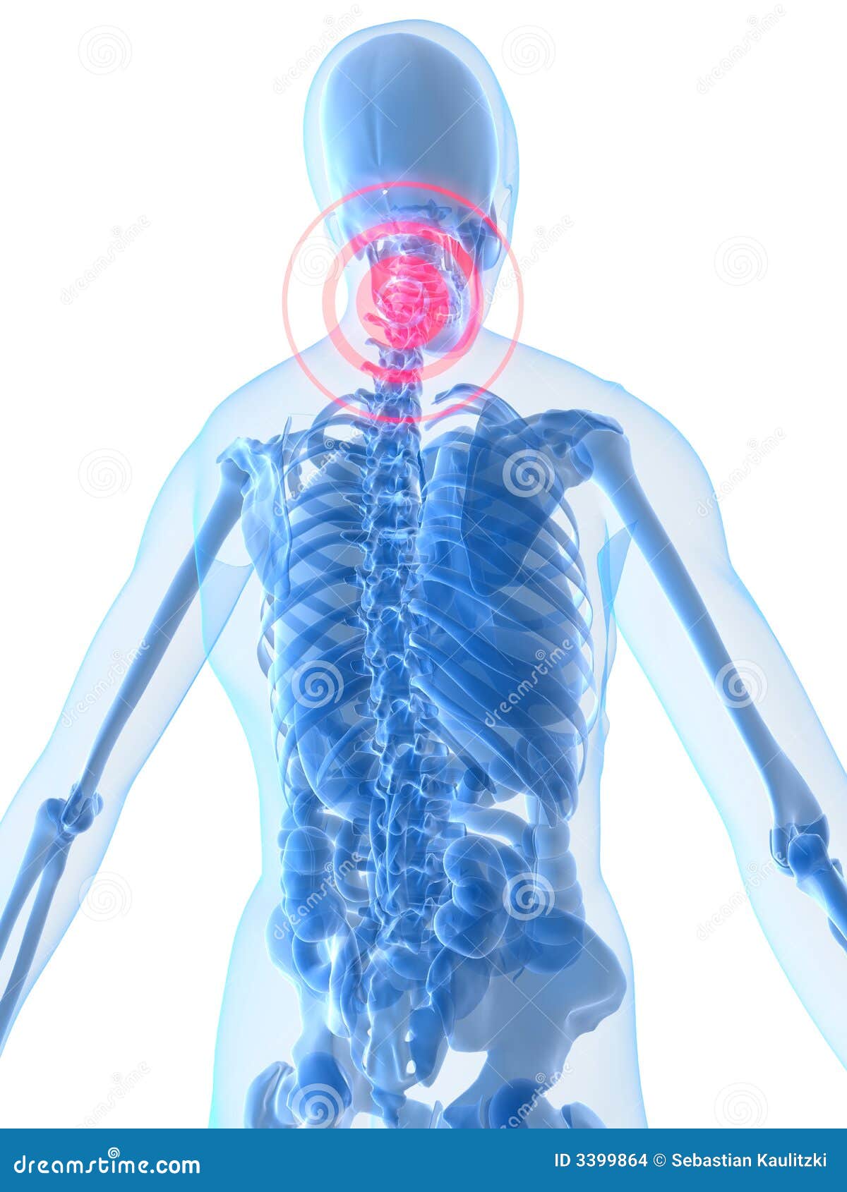 Neck inflammation stock illustration. Image of health 3399864