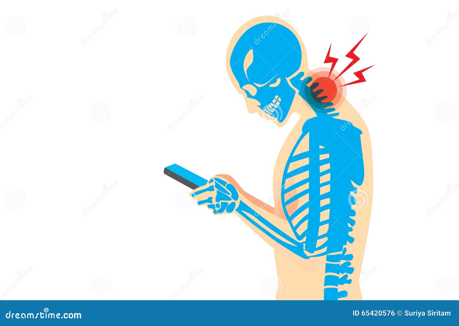 neck pain from smartphone