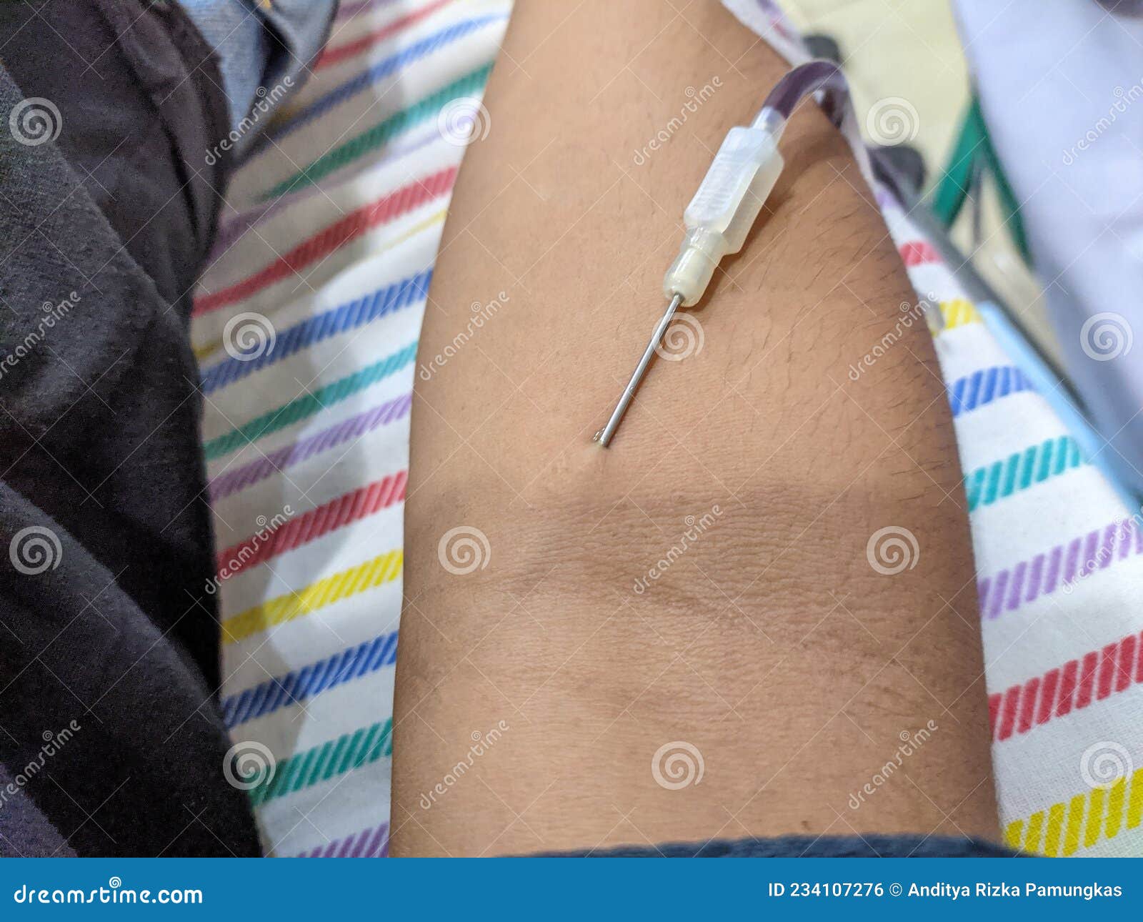 A Needle Pierced His Hand for Blood Transfusion Stock Photo Image of