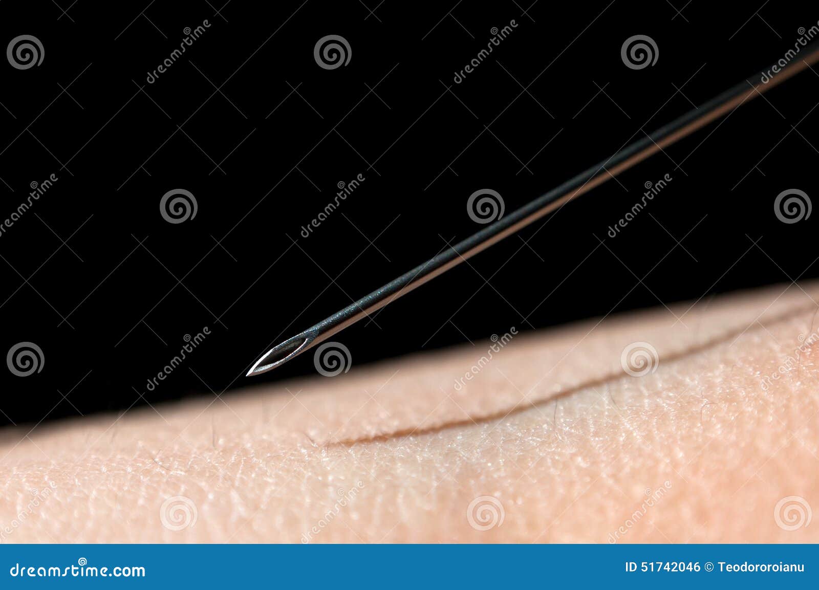 Needle and skin stock photo. Image of arranged, desease 51742046