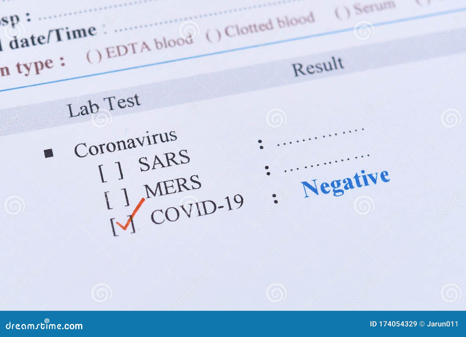 25+ Covid Test Results Negative Picture Pictures