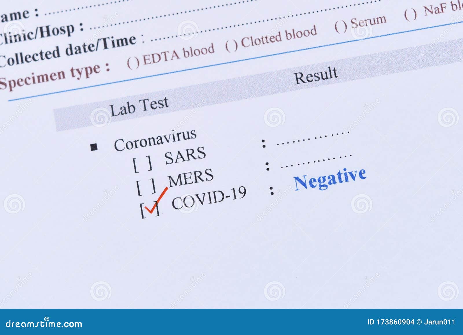 Тест covid 19 результат. Covid-19 negative. Negative Covid Test. Negative Covid Test Result. Covid-19 Results.