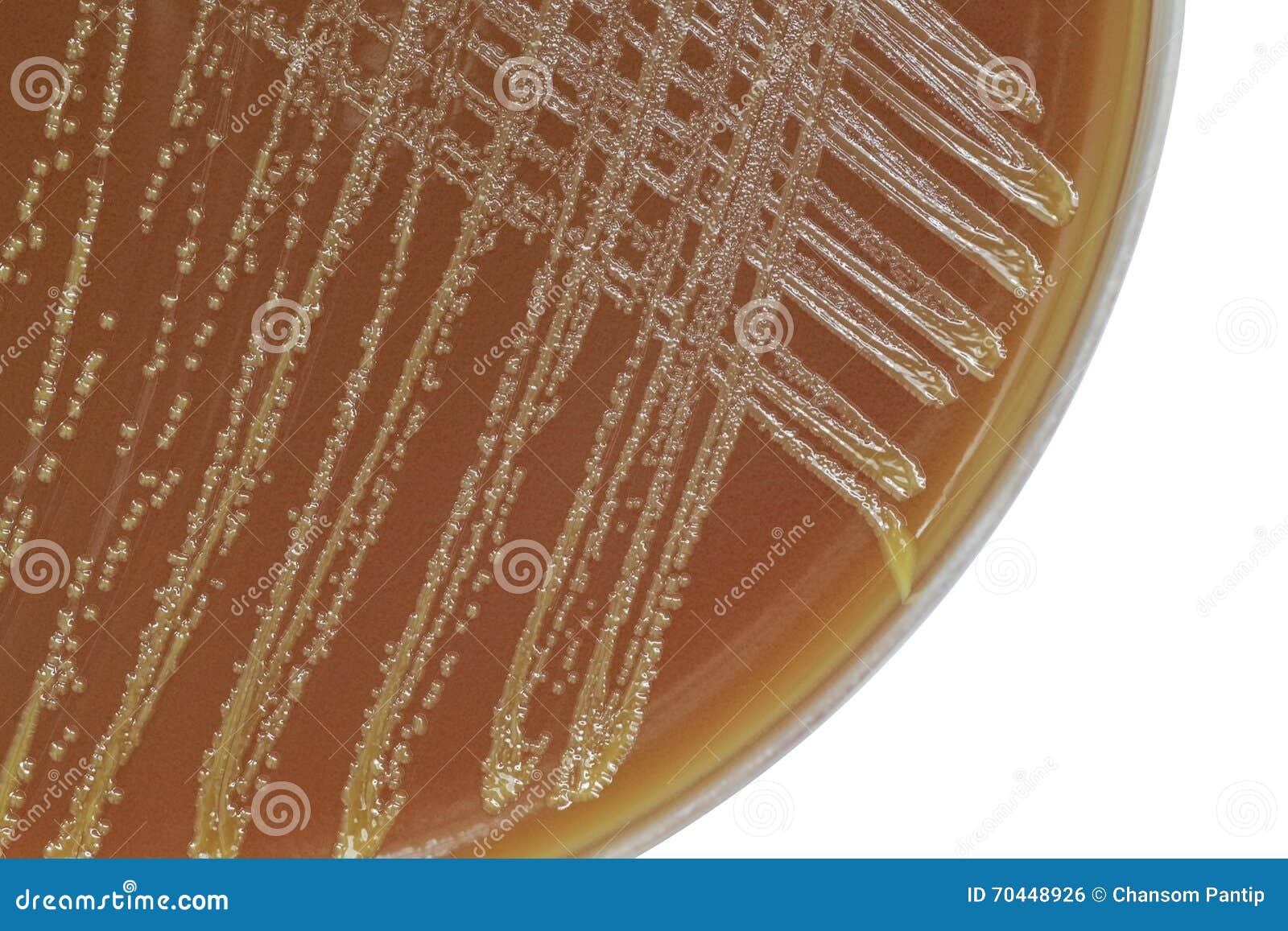 neisseria bacterial colonies on chocolate agar plate