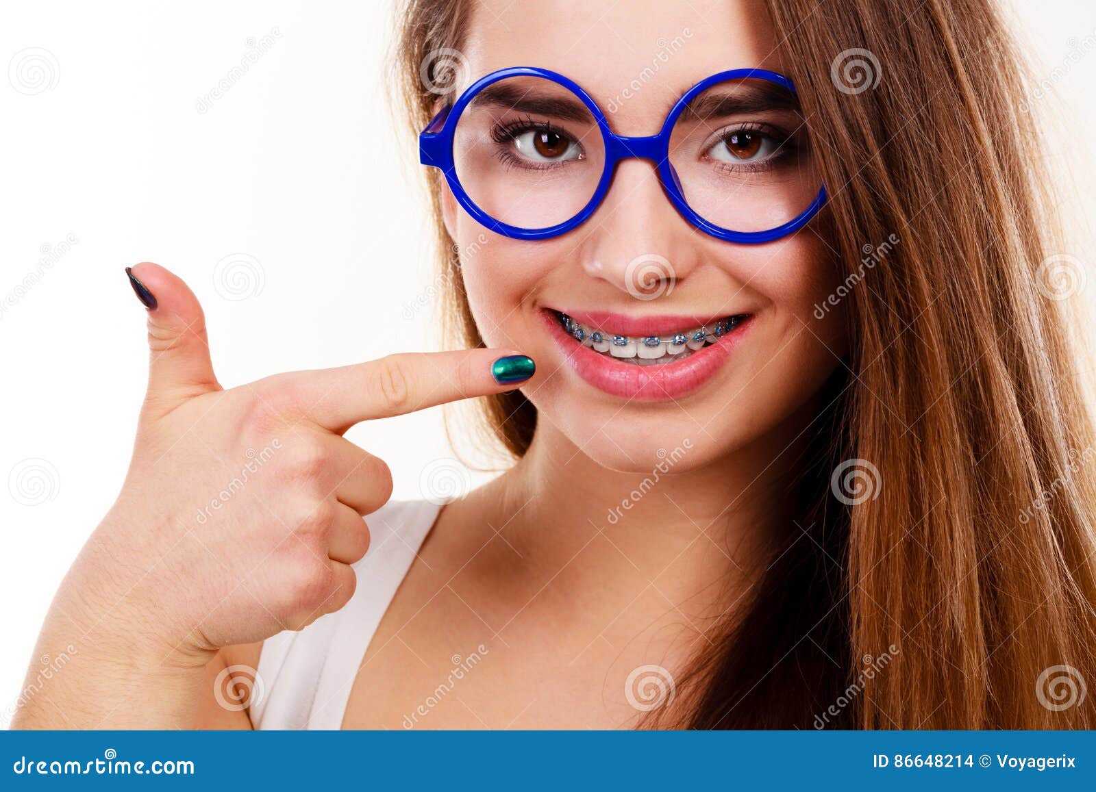 Nerdy Woman Showing Her Teeth With Braces Stock Photo Image Of