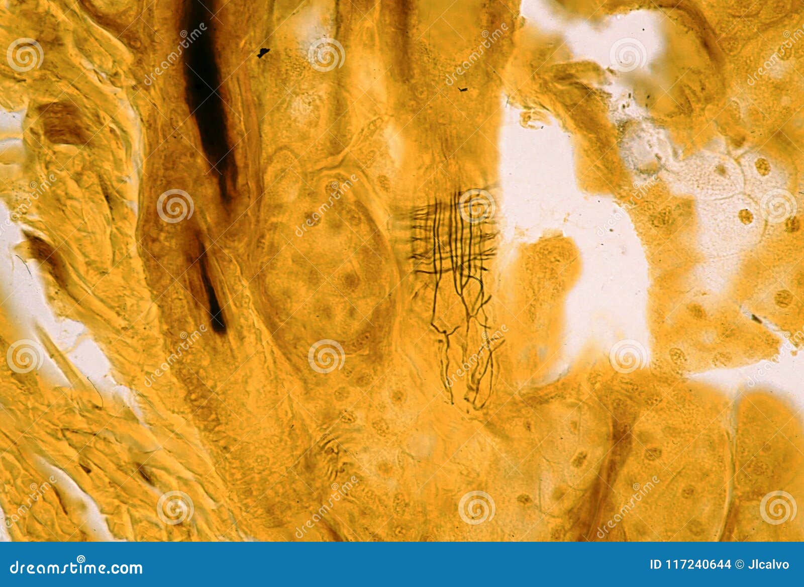 Nerve Endings by Tobi Hill-Meyer Nerve Endings by Tobi Hill-Meyer