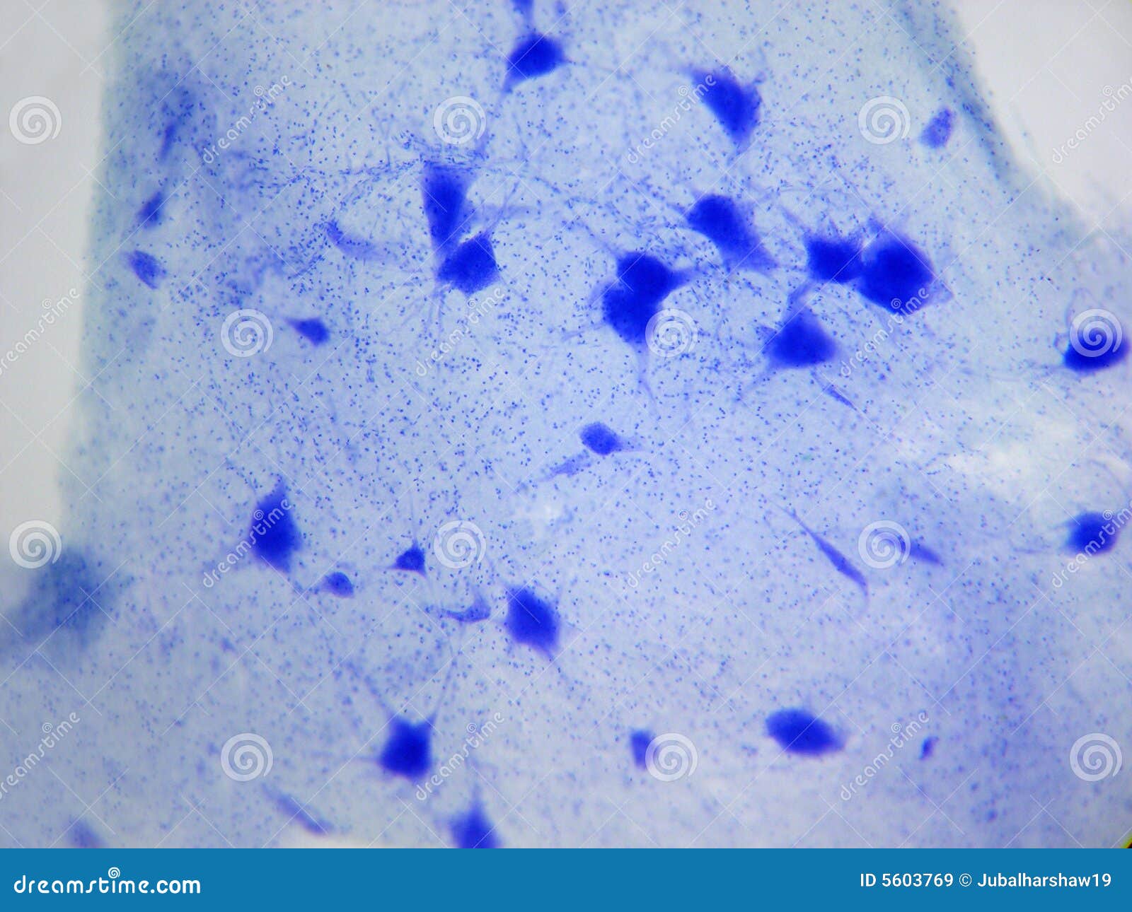 Nervenzellen Stockbild Bild Von Zelle Wissenschaft Neuron