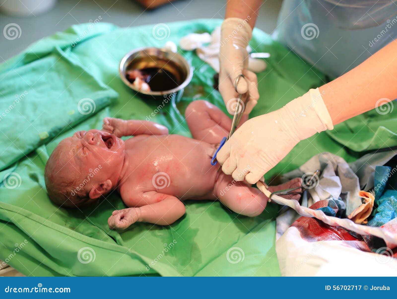 Neugeborenes Baby Nach Geburt Im Krankenhaus Stockbild Bild Von Neugeborenes Krankenhaus