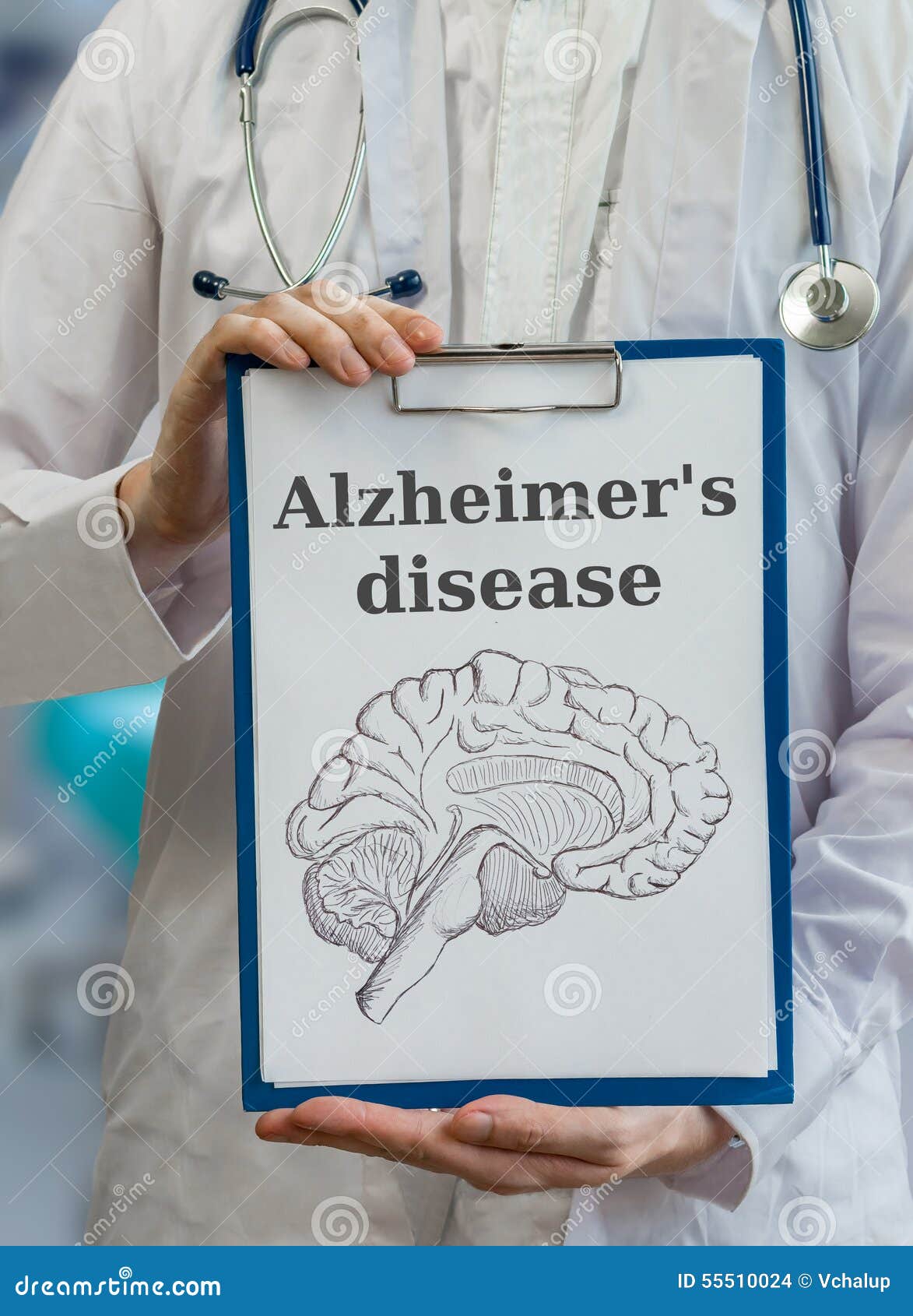 neurologist doctor holds clipboard with alzheimer's disease and