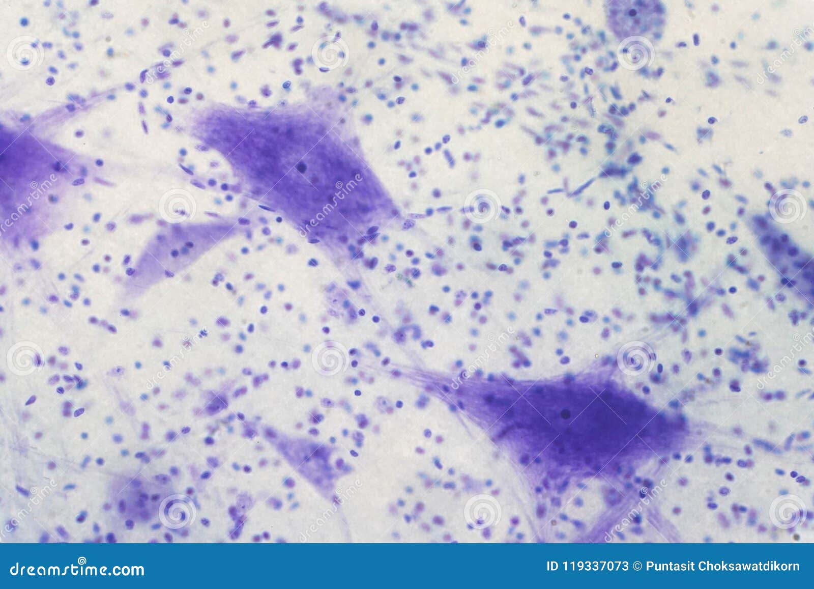 multipolar neuron labeled under microscope