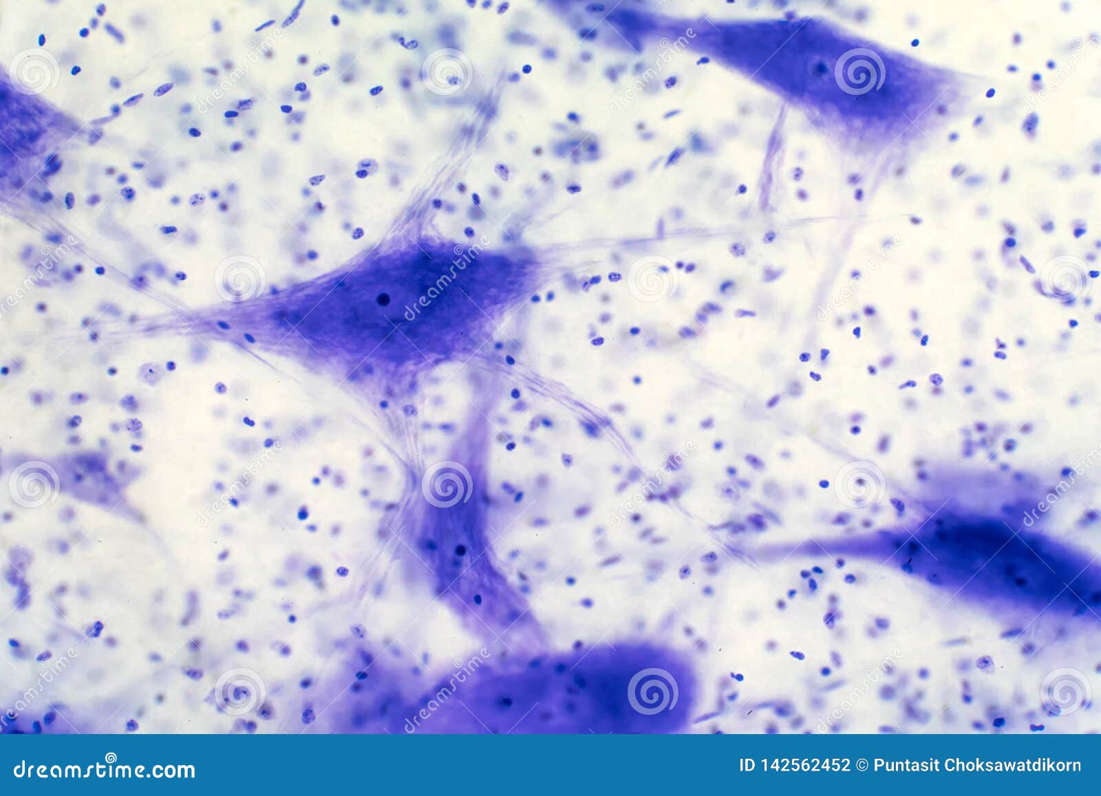 multipolar neuron labeled under microscope