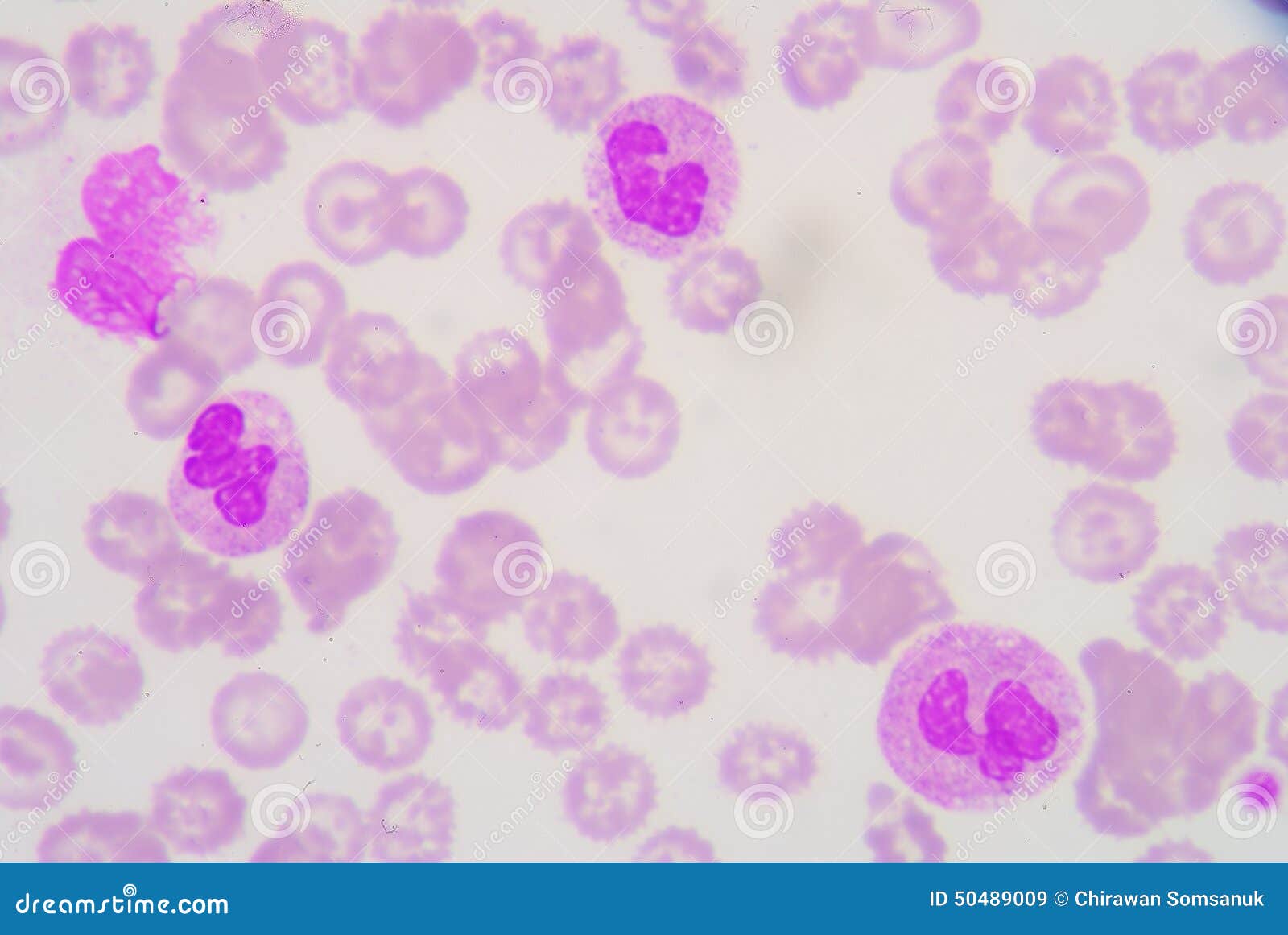 Neutrophil stock image. Image of body, hemoglobin, health 50489009