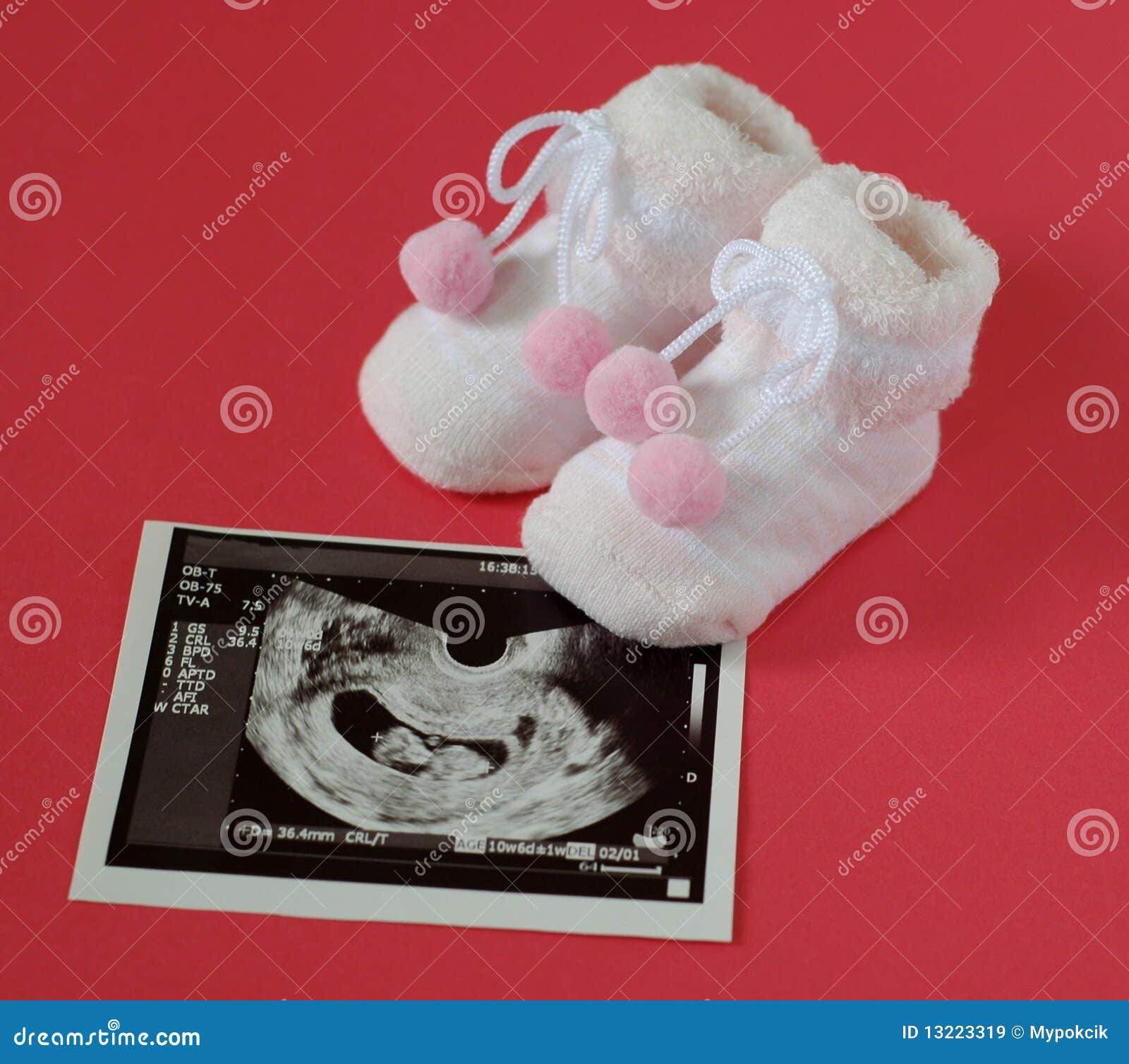 New baby is coming stock image. Image of fetus, birth - 13223319