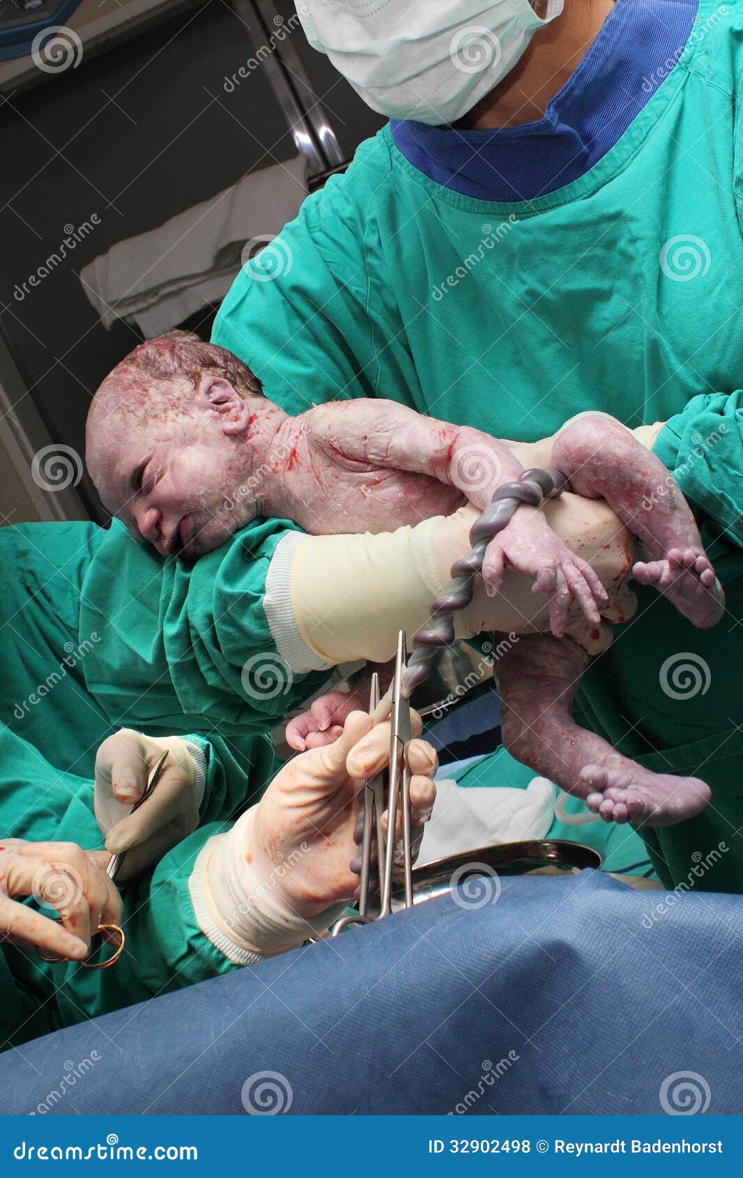 New born baby - girl with remainder of umbilical cord after successful  childbirth. Real birthing and new