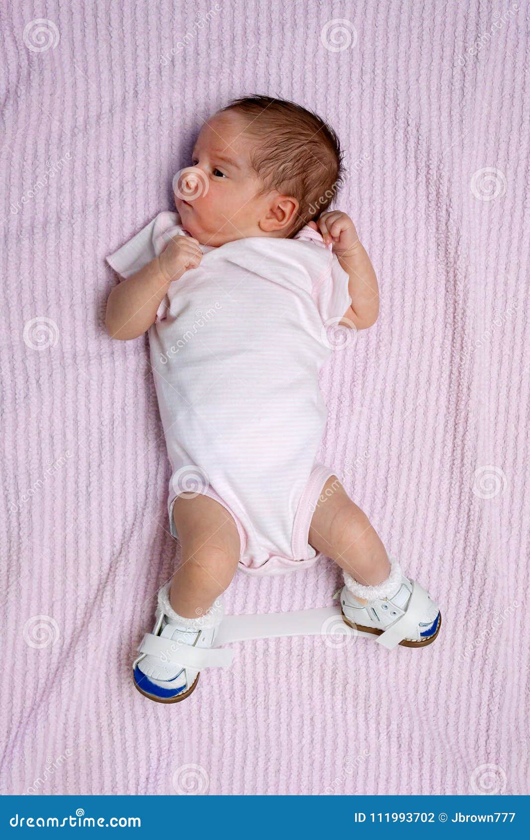 Newborn With Club Foot Wearing Orthopedic Shoes Stock Photo Image Of Congenital Footwear