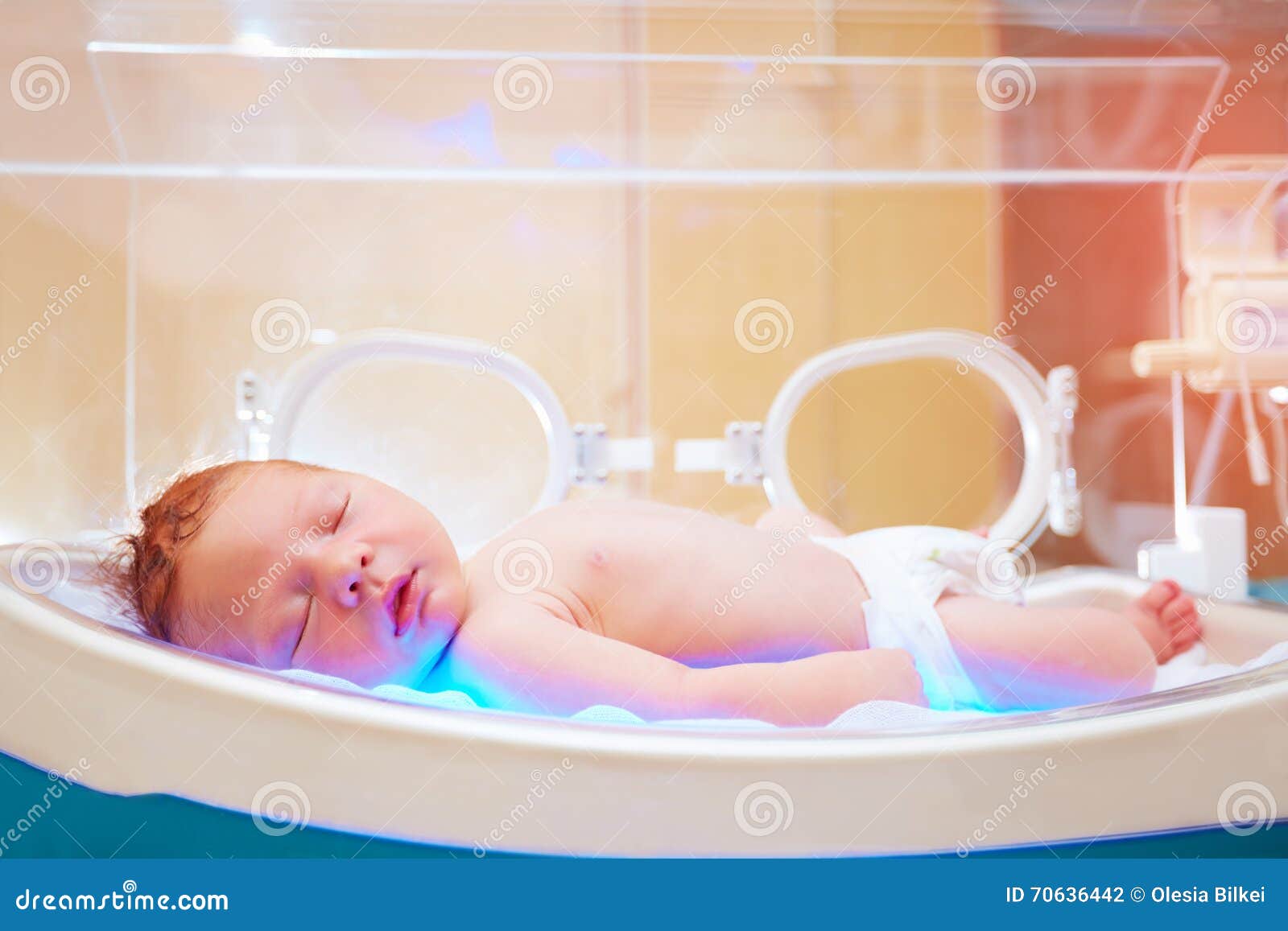 Newborn Baby Get the Light Therapy in Infant Incubator Stock Photo