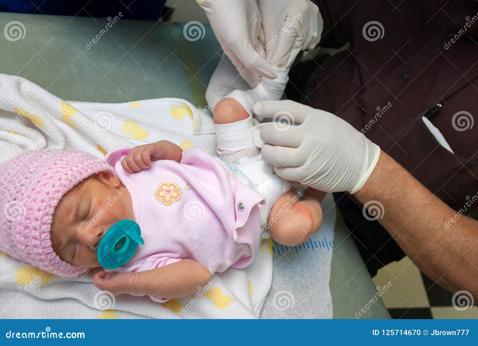 Newborn Baby Girl Born With A Clubfoot Gets A Cast Put On Stock Photo Image Of Anatomy Innocence