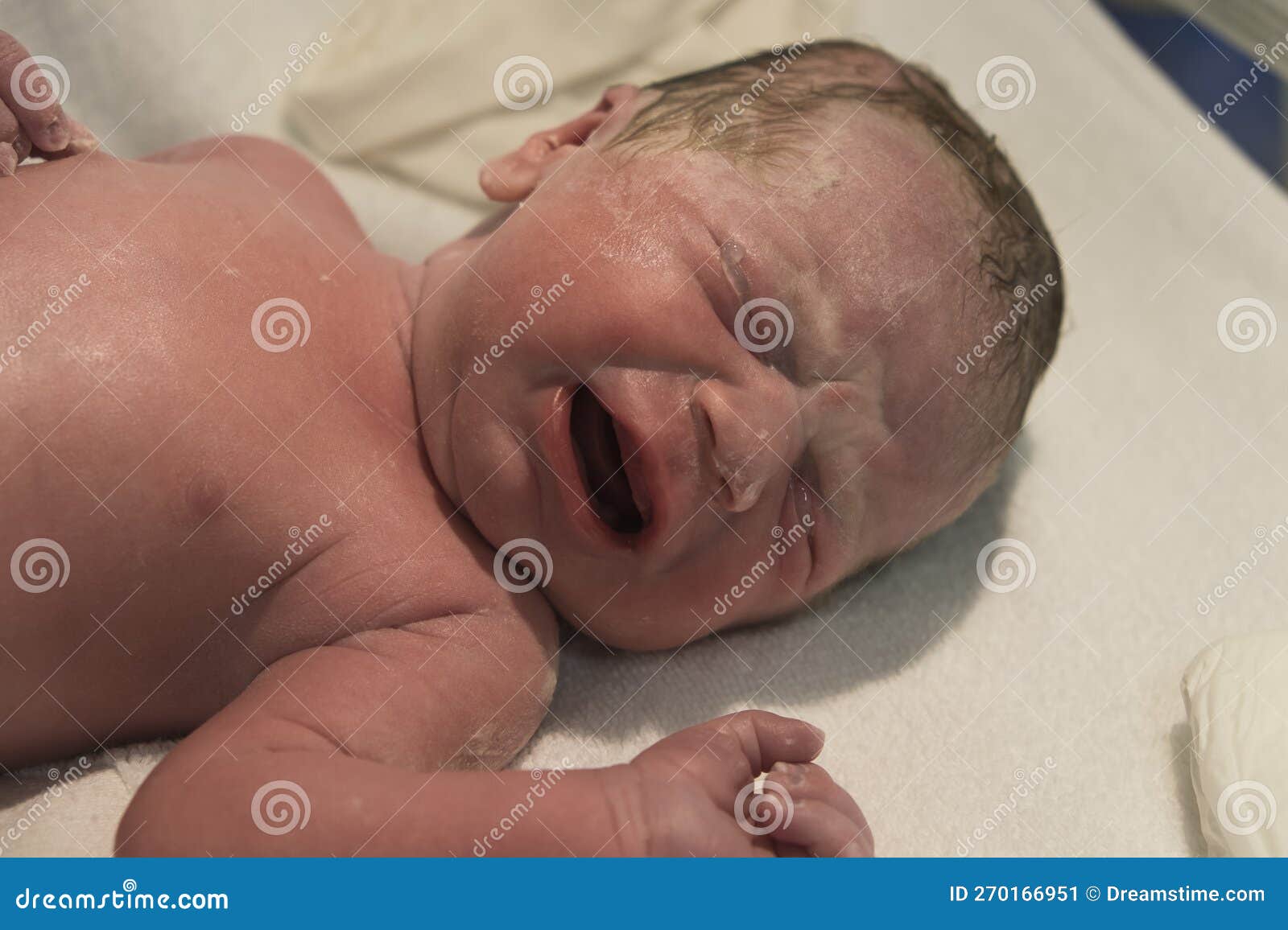newborn baby in postpartum crib still covered in vertix caseosa and with prophylactic ointment to avoid conjunctivitis