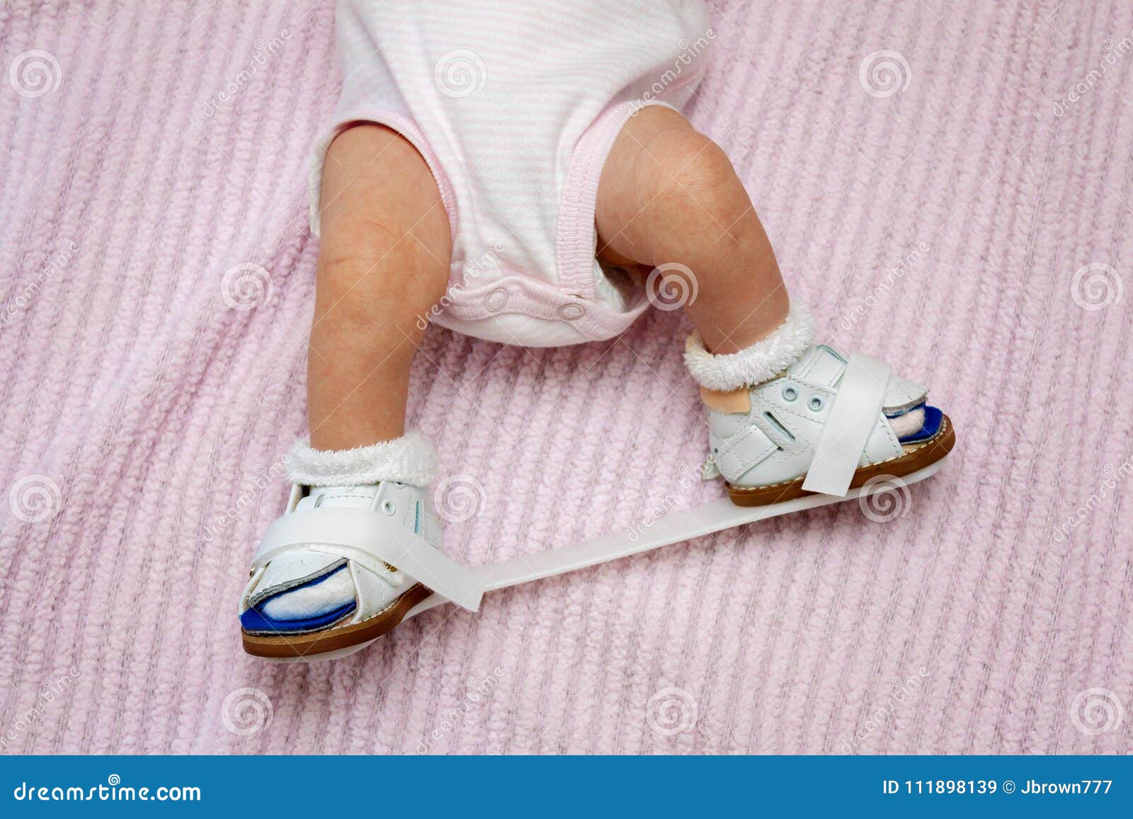 Newborn Orthopedic Shoes stock image. Image of footwear - 111898139
