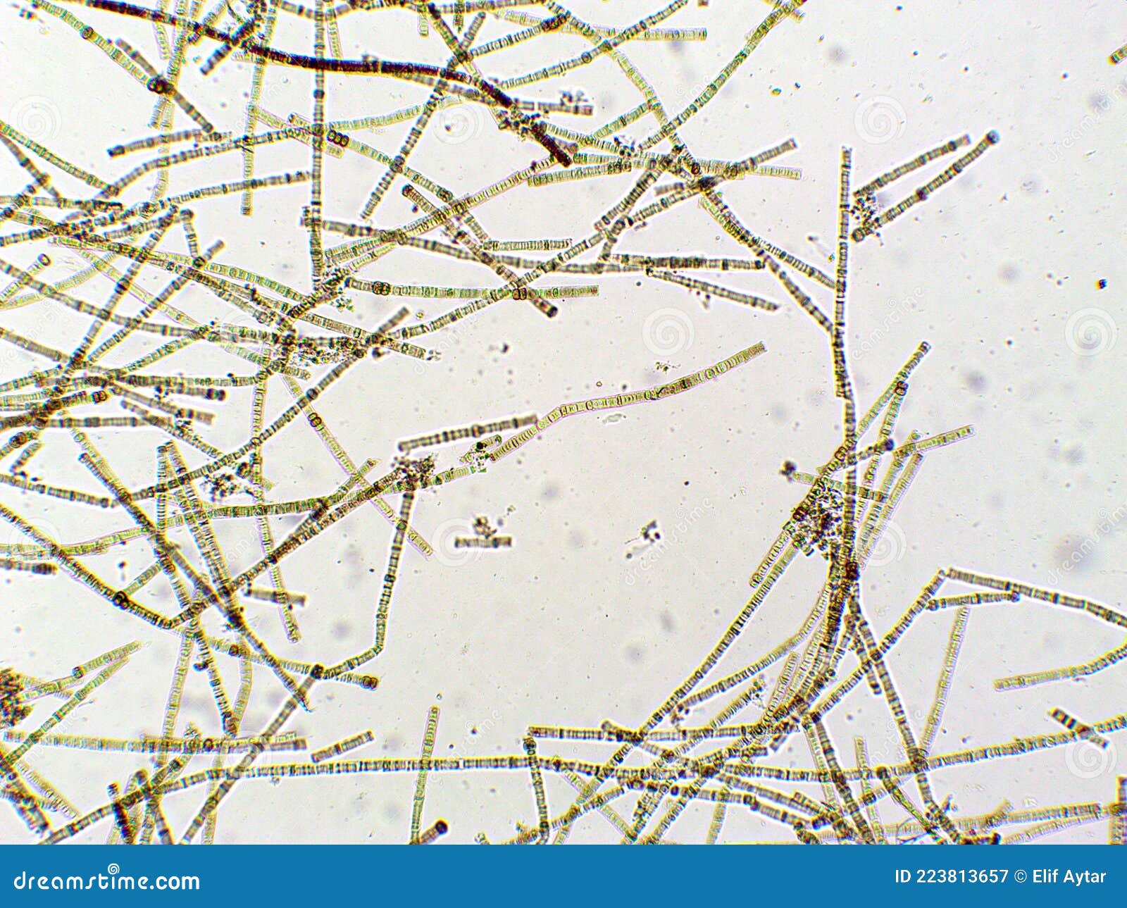 Nodularia Sp. Toxic Algae Under Microscopic View, Nitrogenfixing