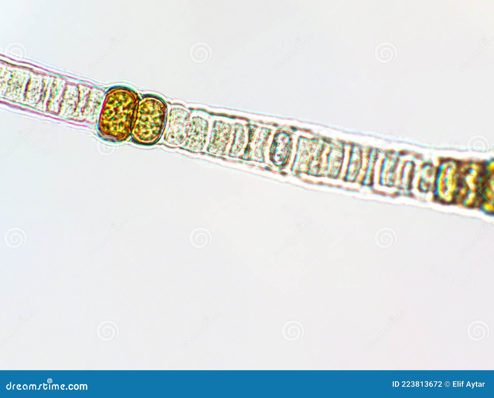 Nodularia Sp. Toxic Algae Under Microscopic View, Nitrogenfixing