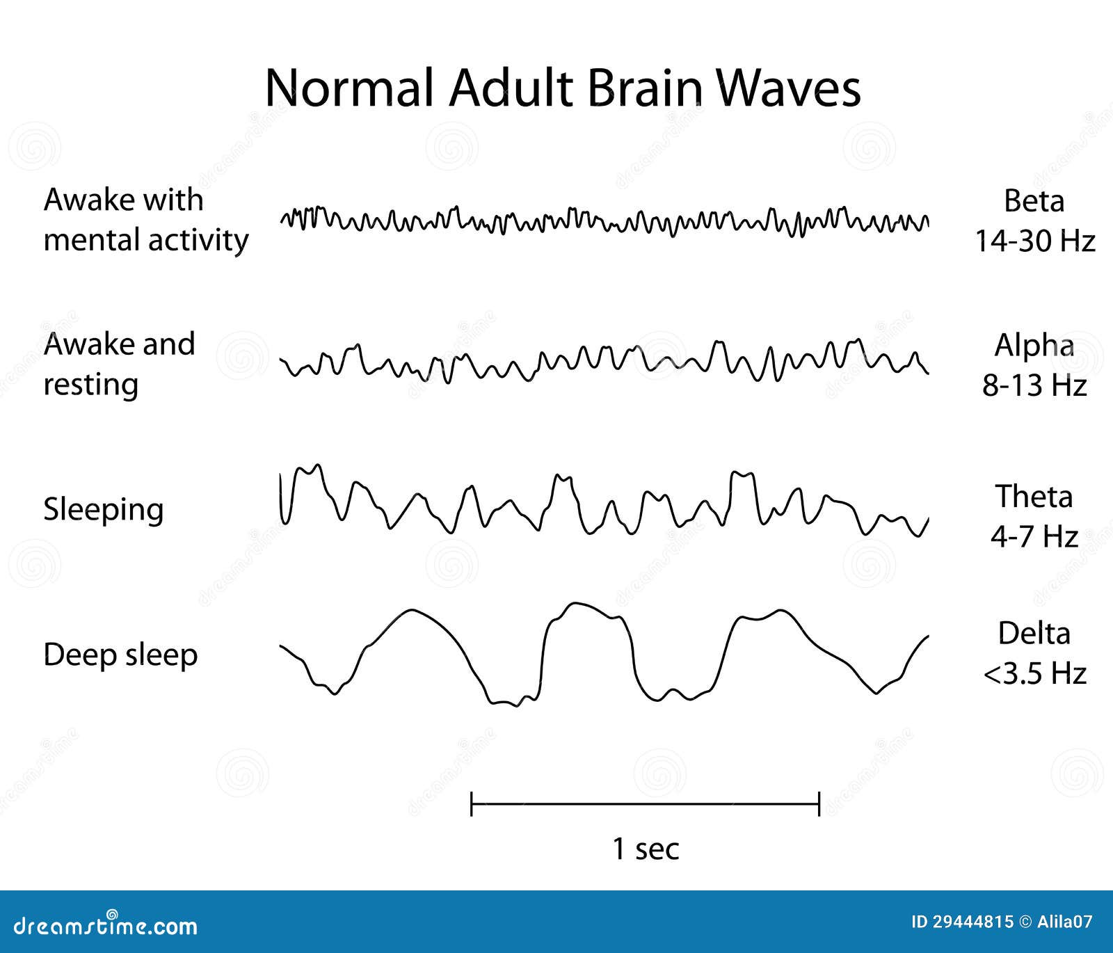 normal eeg