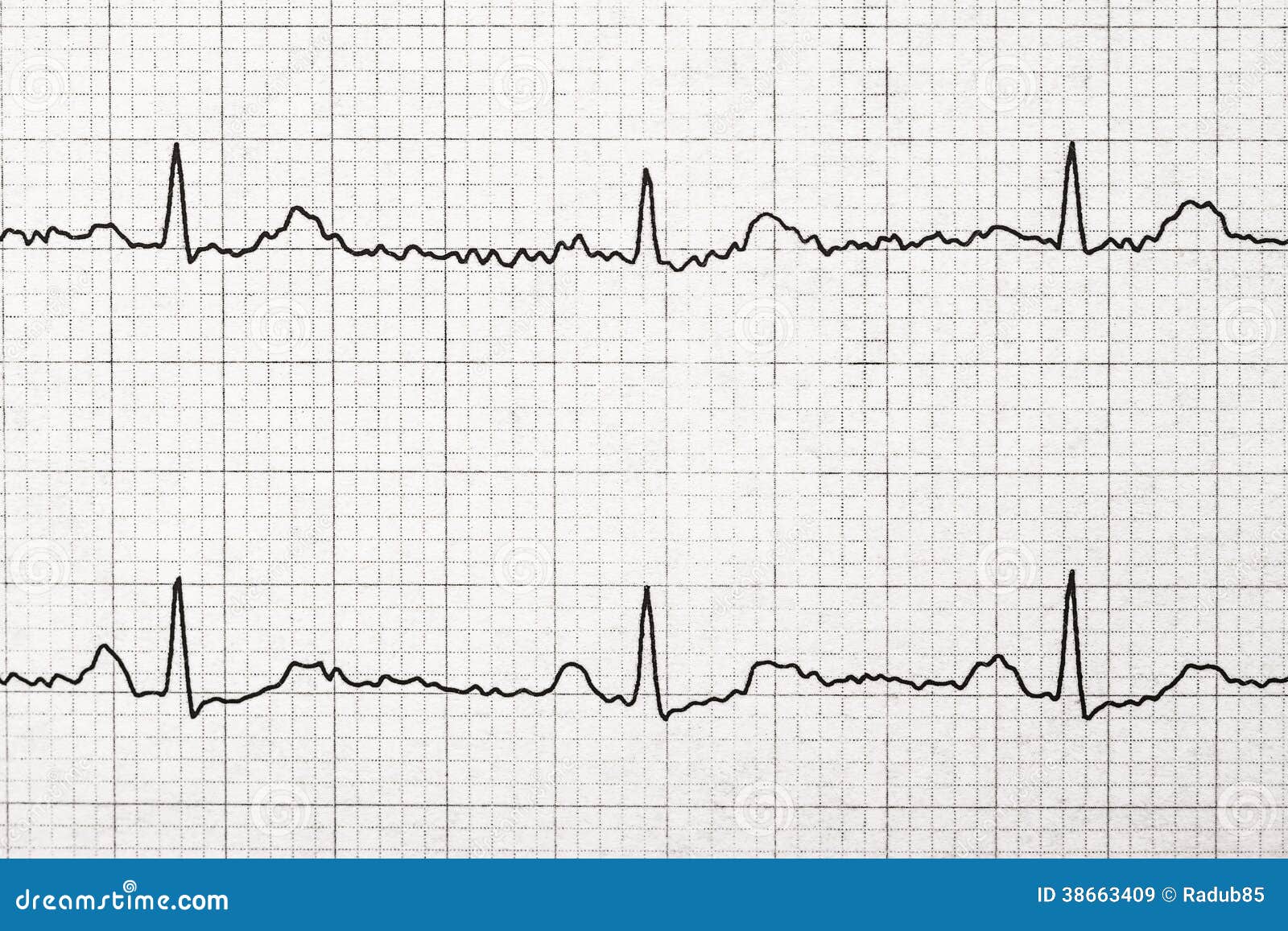heartbeat test Vector Cartoon With Electrocardiogram Paper Normal ECG heartbeat test Vector Cartoon With Electrocardiogram Paper Normal ECG