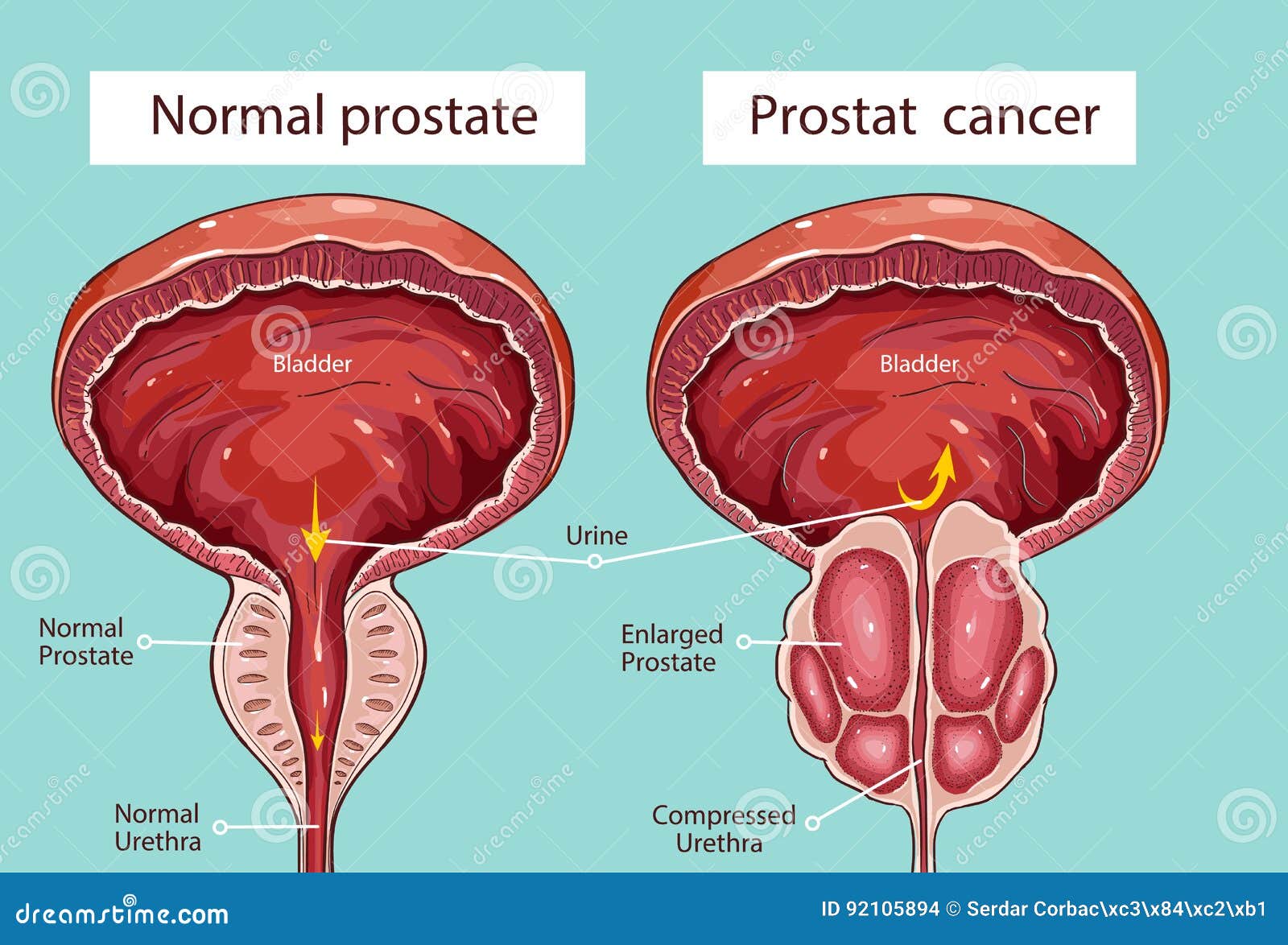 Vitaking PROSTATE COMPLEX (60) - Vitaking - Duovital Webshop