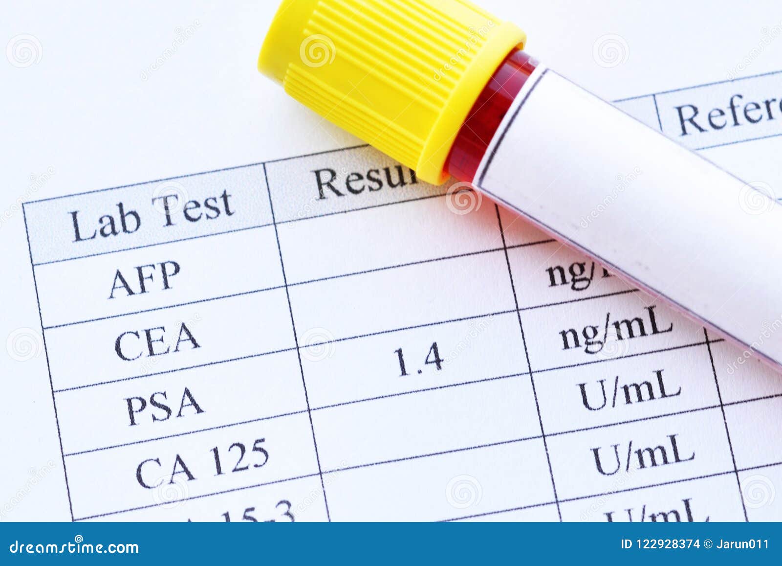 Normal PSA test result stock photo. Image of male, hospital 122928374