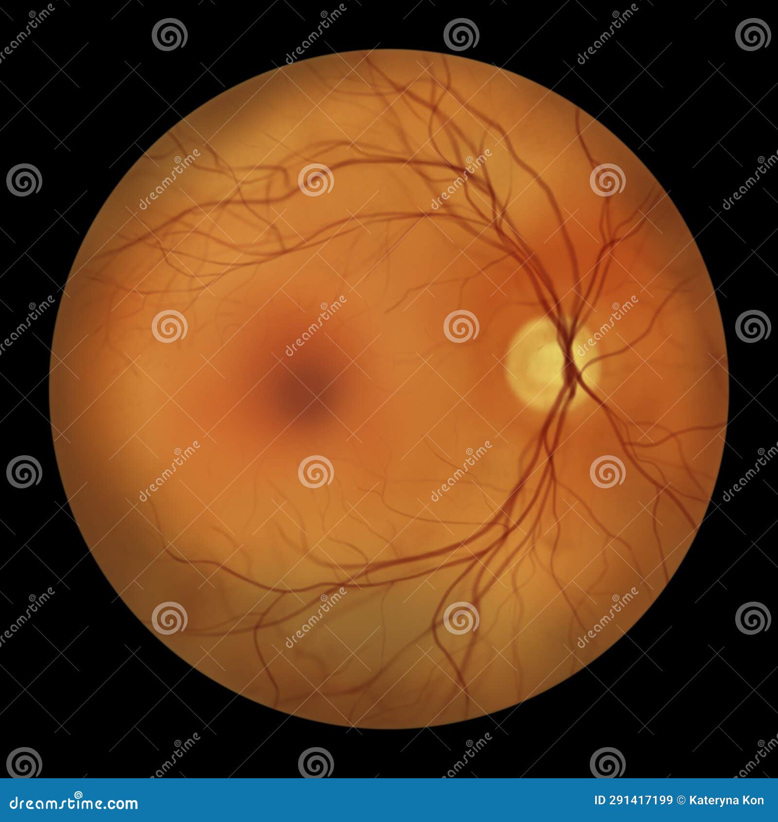 Healthy Retina, Illustration Stock Illustration Illustration of