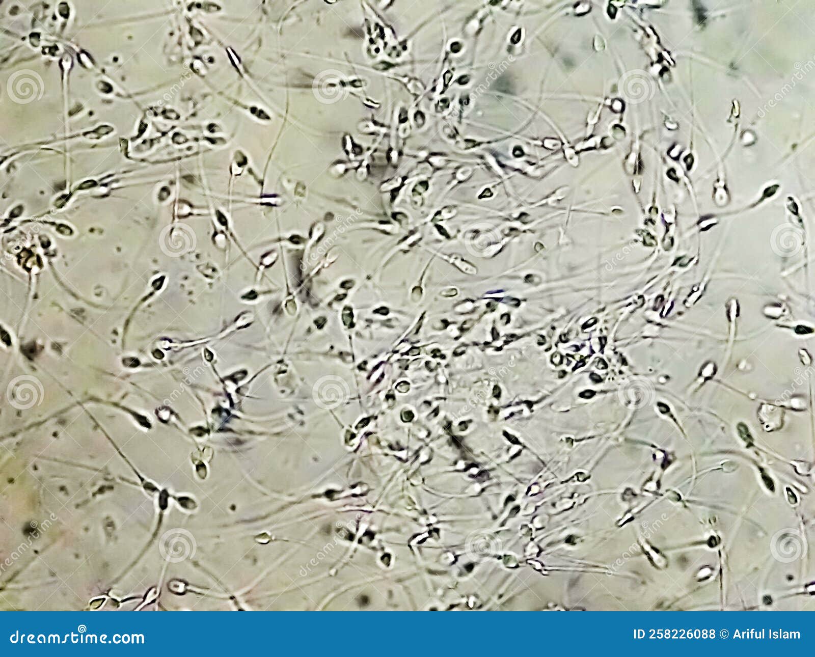 Normozoospermia Analyzed by Microscope Stock Photo - Image of