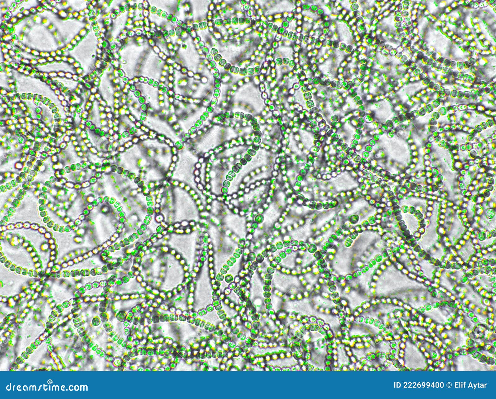 Nostoc Under Microscope Labelled