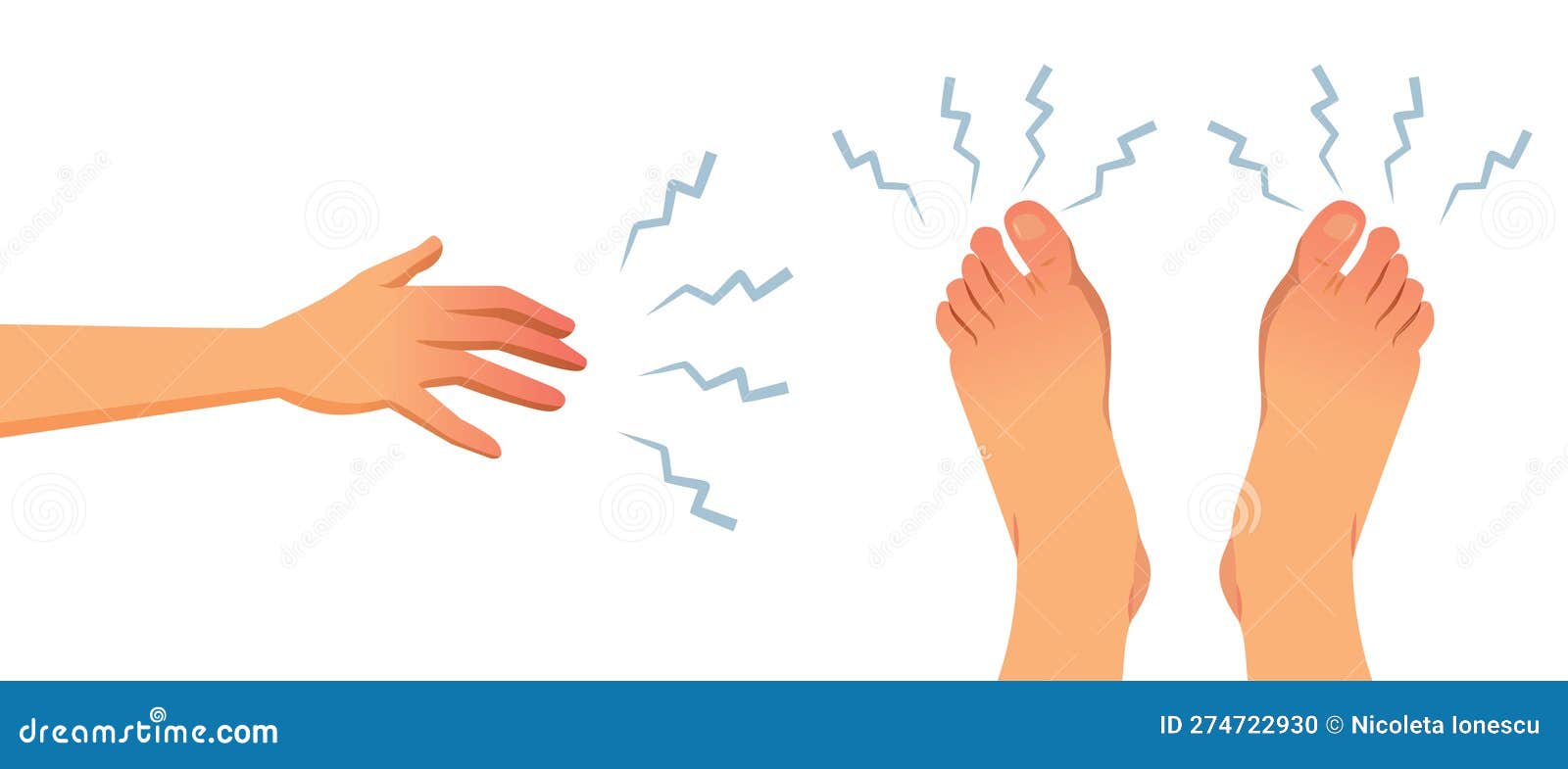 Numbness In Extremities For Feet And Hands Medical Concept Illustration numbness-in-extremities-for-feet-and-hands-medical-concept-illustration