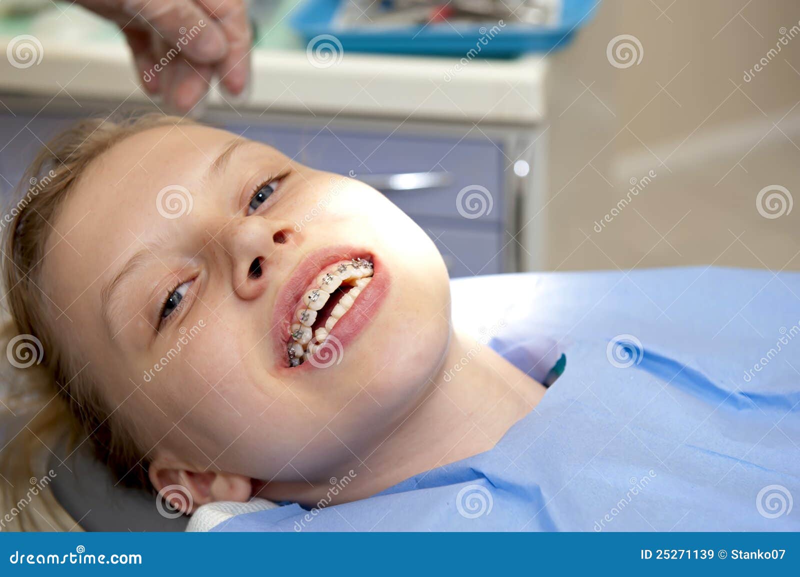 Denti Con Le Parentesi Graffe Fotografia Stock - Immagine Di Apparecchiatura, Sostegni: 43999068 - Foto 2