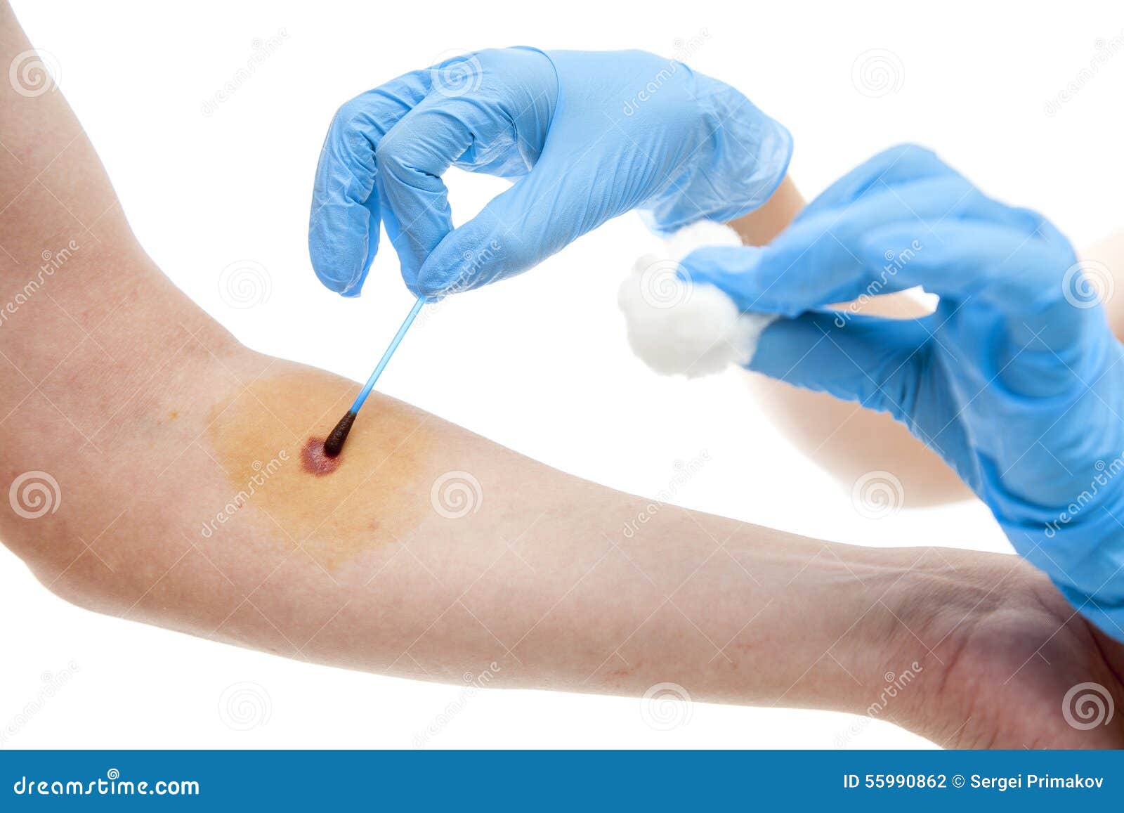 Nurse Applying Iodine Stock Photo Image Of Research 55990862