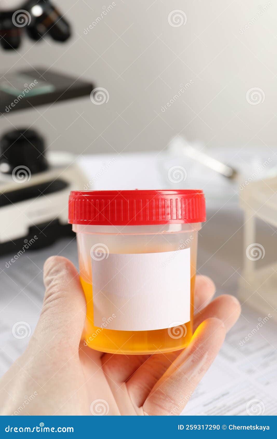 Nurse Holding Container with Urine Sample for Analysis in Laboratory, Closeup Stock Photo