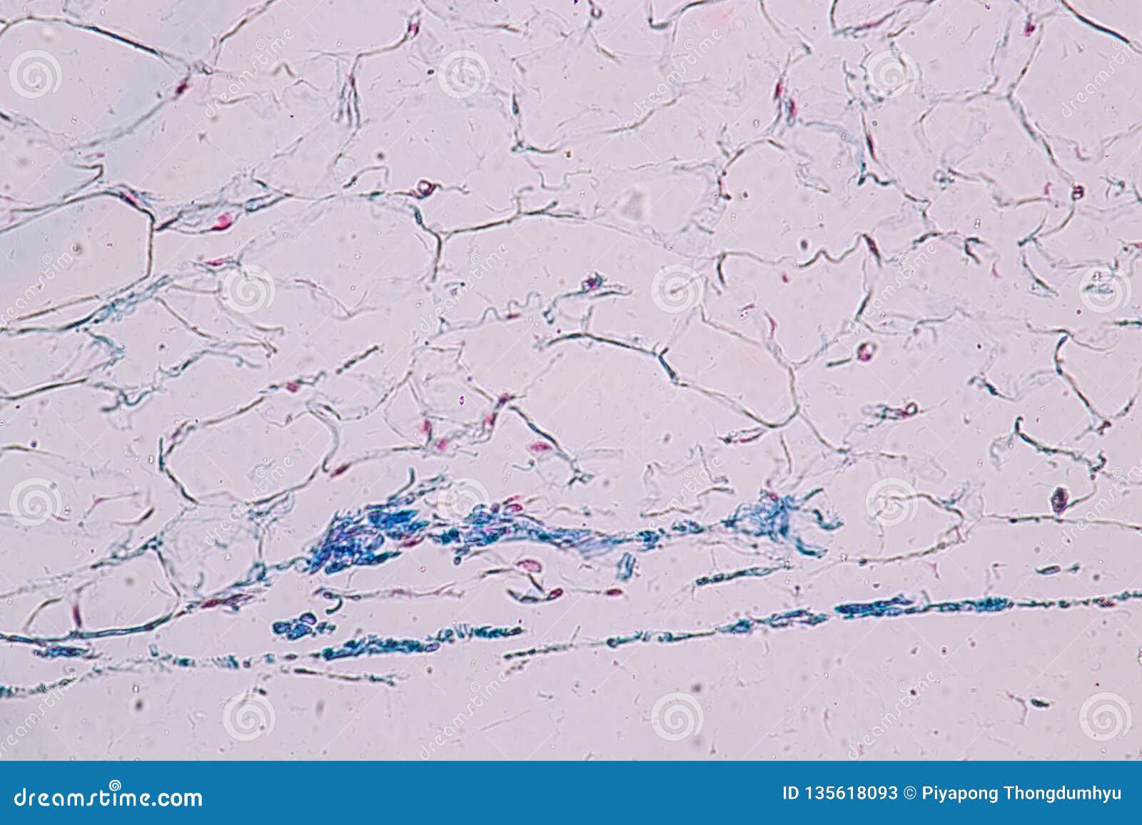 O Tecido Adiposo Gordura Corporal Simplesmente Gordura E Um Tecido Conjuntivo Fraco Sob O Microscopico Imagem De Stock Imagem De Conexivo Fibra O Tecido Adiposo Gordura Corporal Simplesmente Gordura E Um Tecido Conjuntivo Fraco Sob O Microscopico Imagem De Stock Imagem De Conexivo Fibra