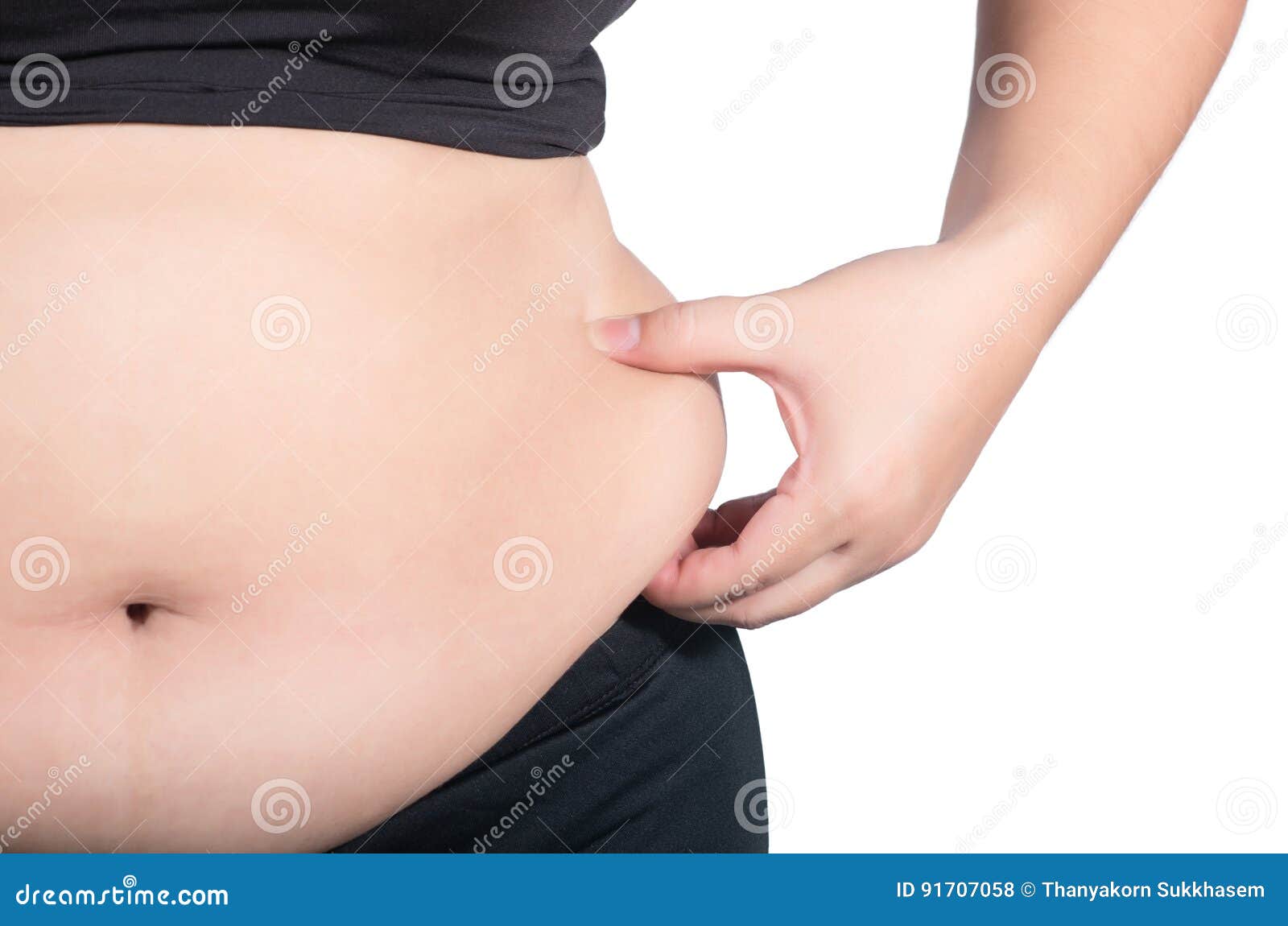 Female hanging belly with stretch marks on skin closeup. Overweight woman  flaunt figure Stock Photo by burmistrovaiuliia