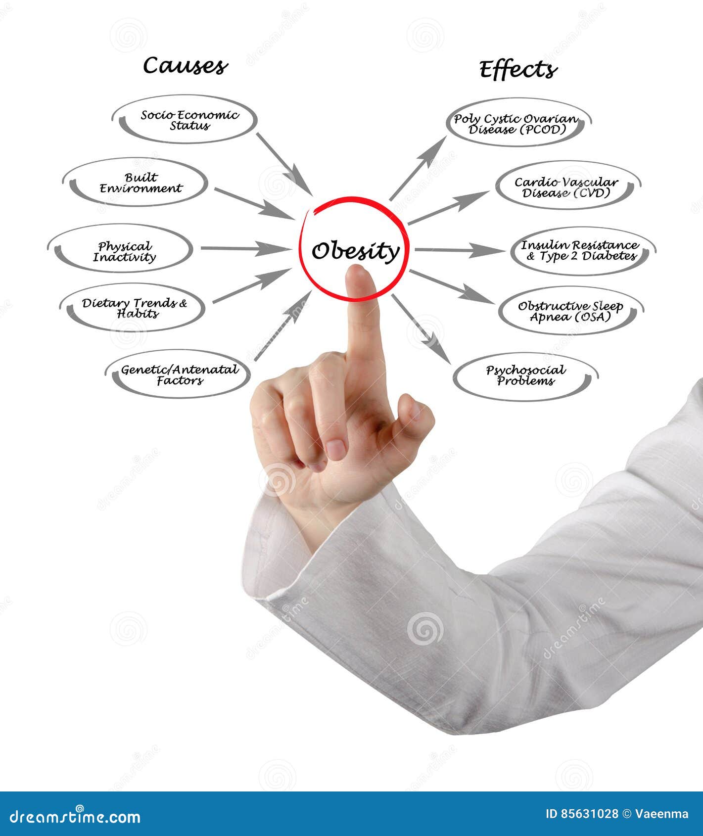 Diabetes And Obesity Diabetes And Obesity