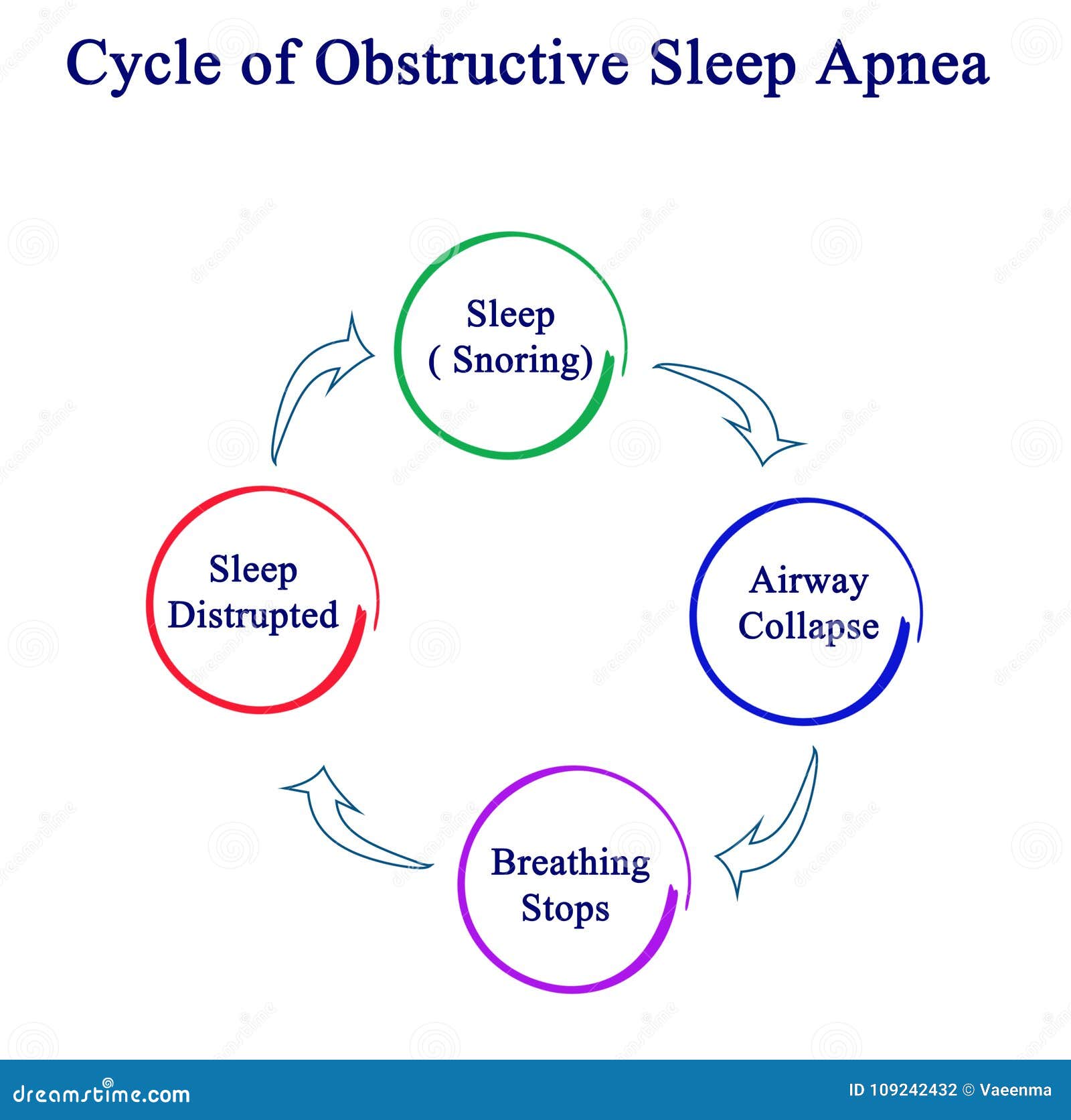Obstructive Sleep Apnea stock illustration. Illustration of concept